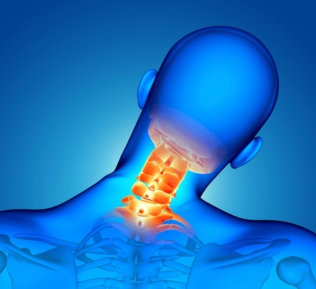 Signe de Lhermitte quan preocuparme per la meva hèrnia cervical Juan Aibar Neurocirugia